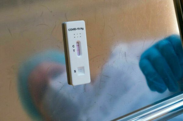 Инфекционист: В Москве хватит тестов для варианта коронавируса «кентавр» Инфекционист: В Москве хватит тестов для варианта коронавируса «кентавр»