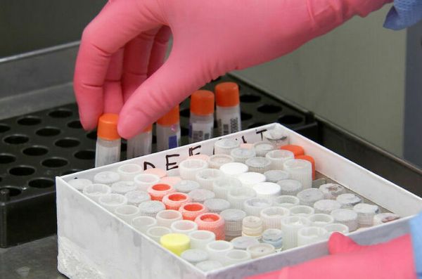 Онищенко оценил действия врачей Подмосковья в случае с сибирской язвой